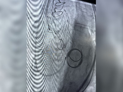 mauritius-tavr-11